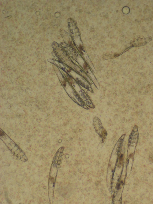 Фотографии демодекоза под микроскопом
