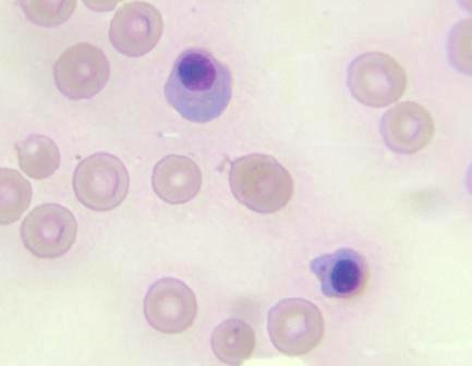 Базофильные нормоциты в крови собаки при гемангиосаркоме селезёнки