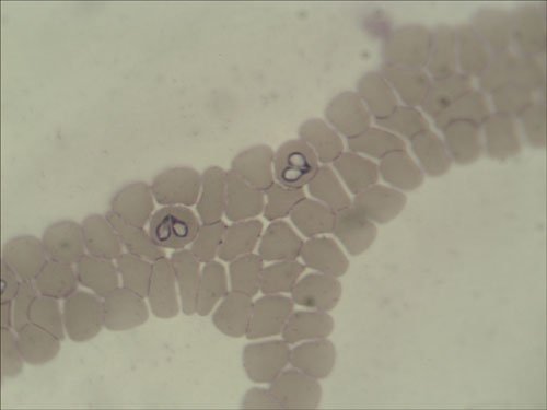 Пироплазма под микроскопом